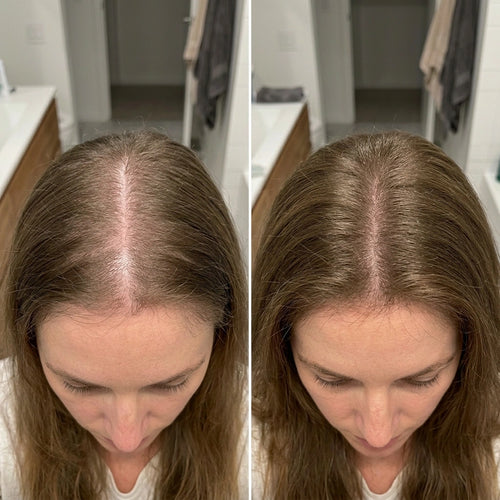 Marie, 31